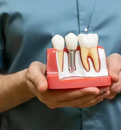 Dentist reviewing a dental implant model with a patient