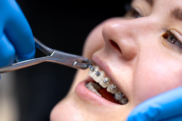 Patient reviewing orthodontic treatment options with a dental professional